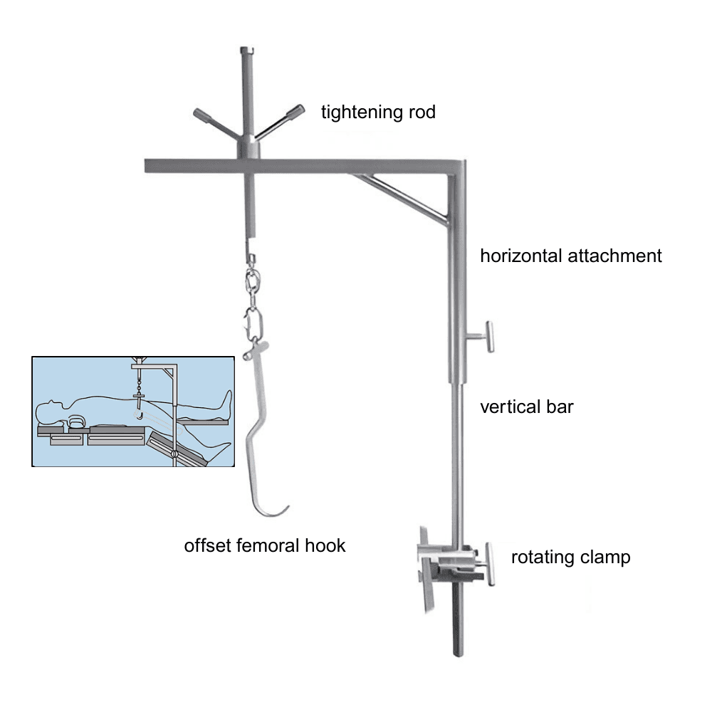Wixson Anterior Suspension Hook System