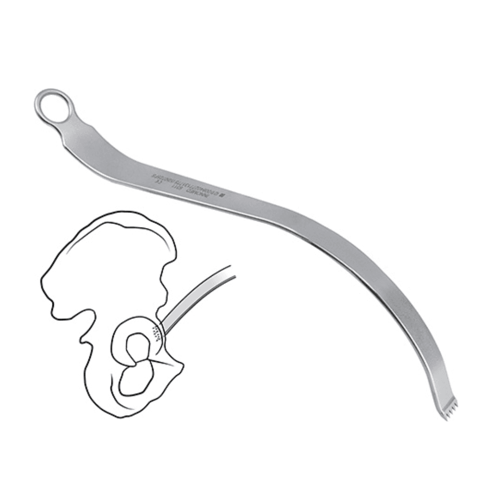 Chandran Anterior Retractor for THR