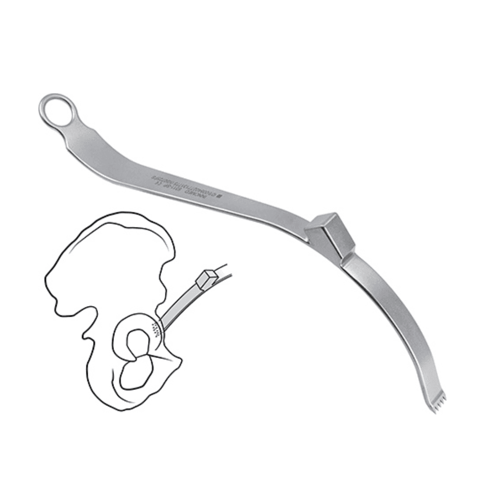 Chandran Anterior Retractor for THR with Strikeplate