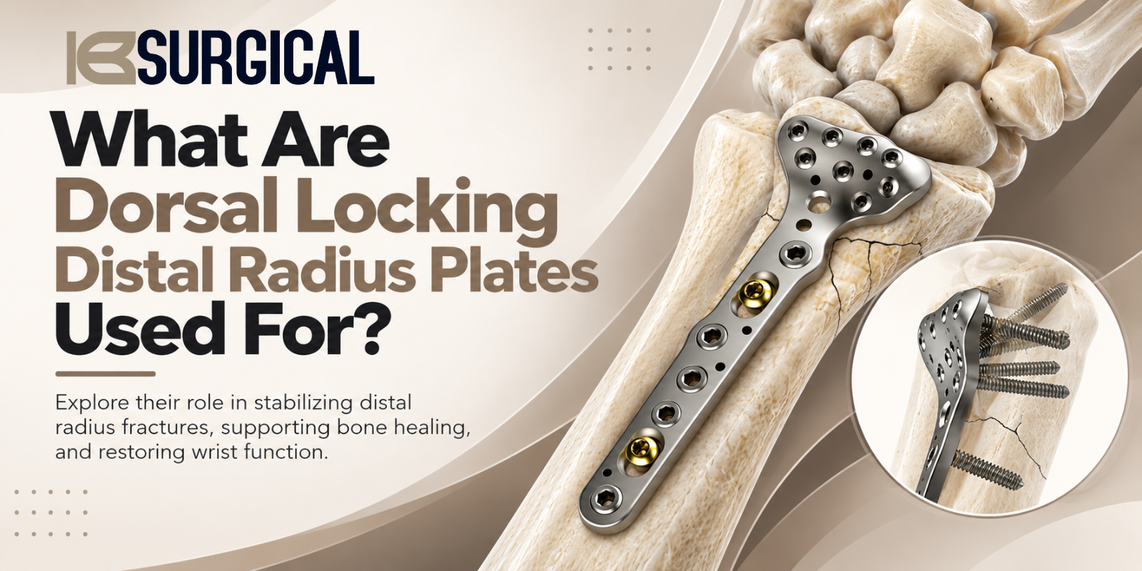 What Are Dorsal Locking Distal Radius Plates Used For?
